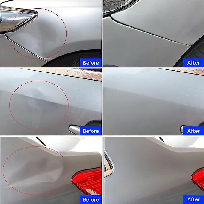 Car Paintless Dent Repair Kit - Suction Puller Set