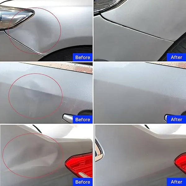 Car Paintless Dent Repair Kit - Suction Puller Set